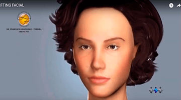 Procedimento cirgurgico